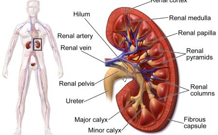 Don't forget to eat these things if you have kidney stones!